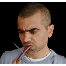 KOPMUŞ KESİK DİĹ